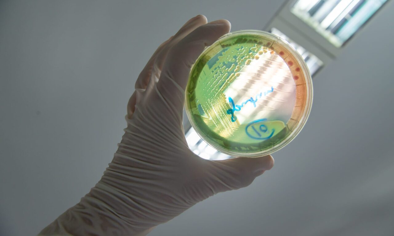 $2M NIH Grant to Address Pseudomonas-Linked Lung Infections
