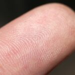Fingertip Sweat Test Tracks Antibiotics Use in Tuberculosis Patients