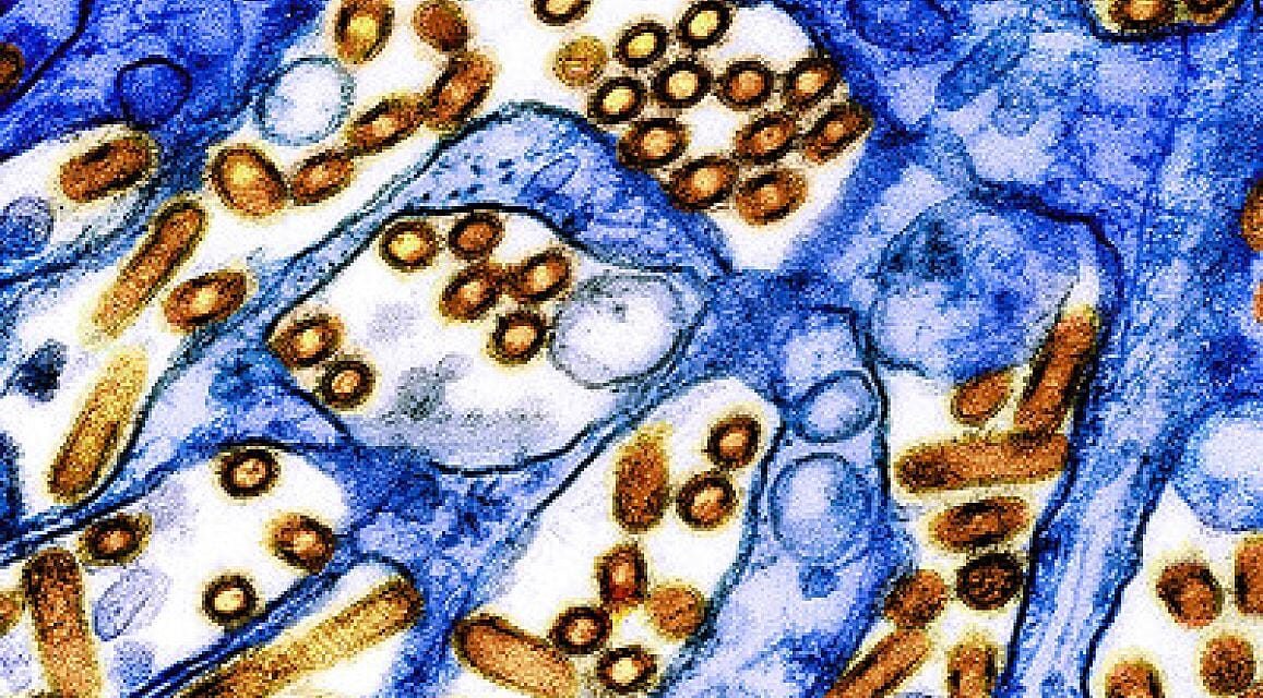 Biosensor Can Detect Airborne Bird Flu in Under Five Minutes