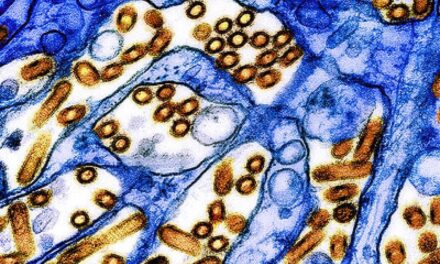 Biosensor Can Detect Airborne Bird Flu in Under Five Minutes