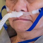 High-flow Nasal Cannula Reduced Intubation, Not Mortality