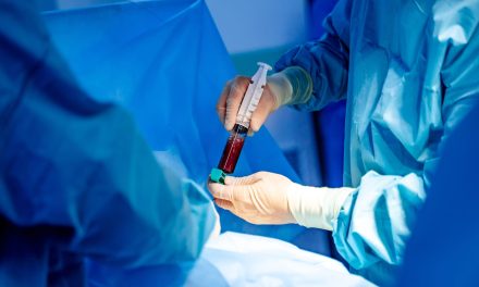 Milder Blood Stem Cell Transplants Preserves Lung Function in Sickle Cell Patients