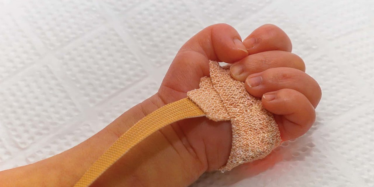 Pulse Oximetry and Patient Monitoring in the NICU / PICU