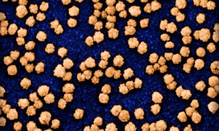 COVID-19 Raises Heart Attack, Stroke Risk for Up to Three Years