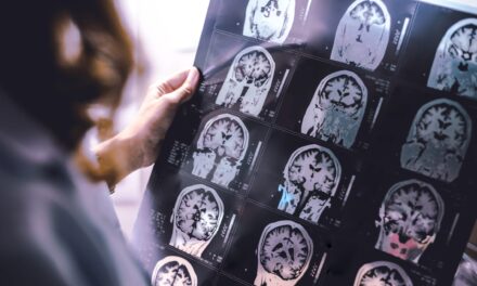 Sleep Apnea Linked to Increased Brain Growth