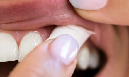 AHA Calls for Policies to Curb Use of Oral Nicotine Products