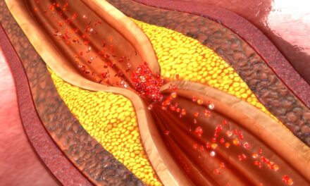 Post-COVID Inflammation Fuels Coronary Artery Plaque Growth