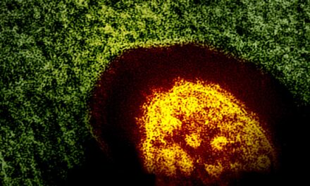 California Child Dies of Measles-related Brain Disorder