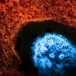 US Measles Total Breaks 2,000 Cases for the Year