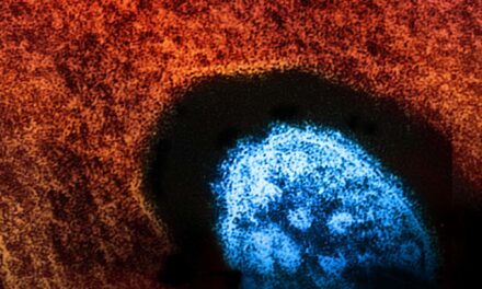 Texas Measles Outbreak: 597 Cases