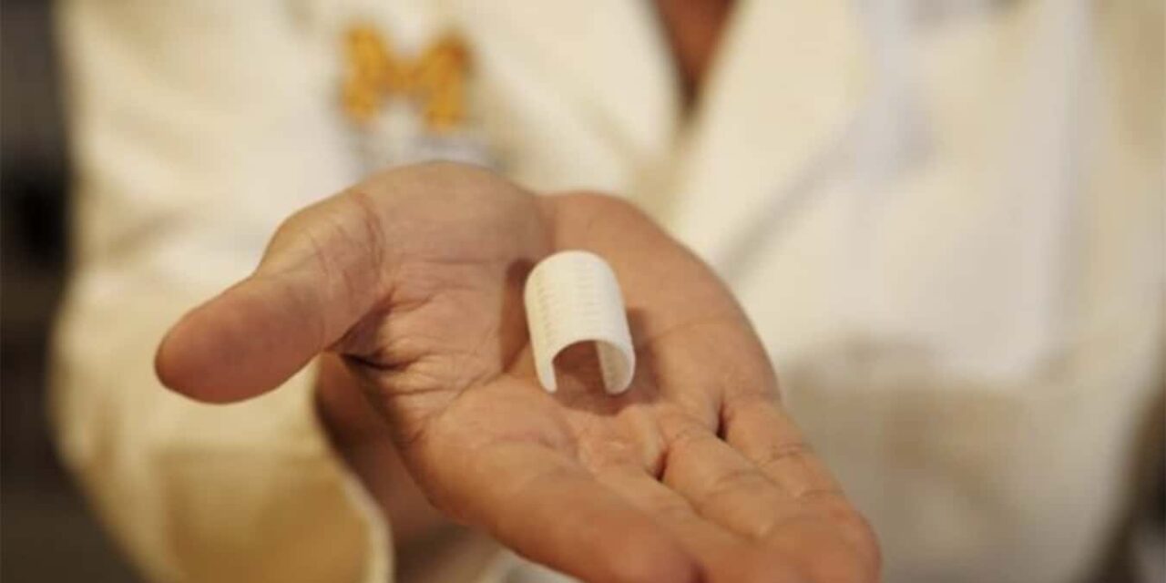 3D Printed Airway for Tracheobronchomalacia Begins Clinical Trials