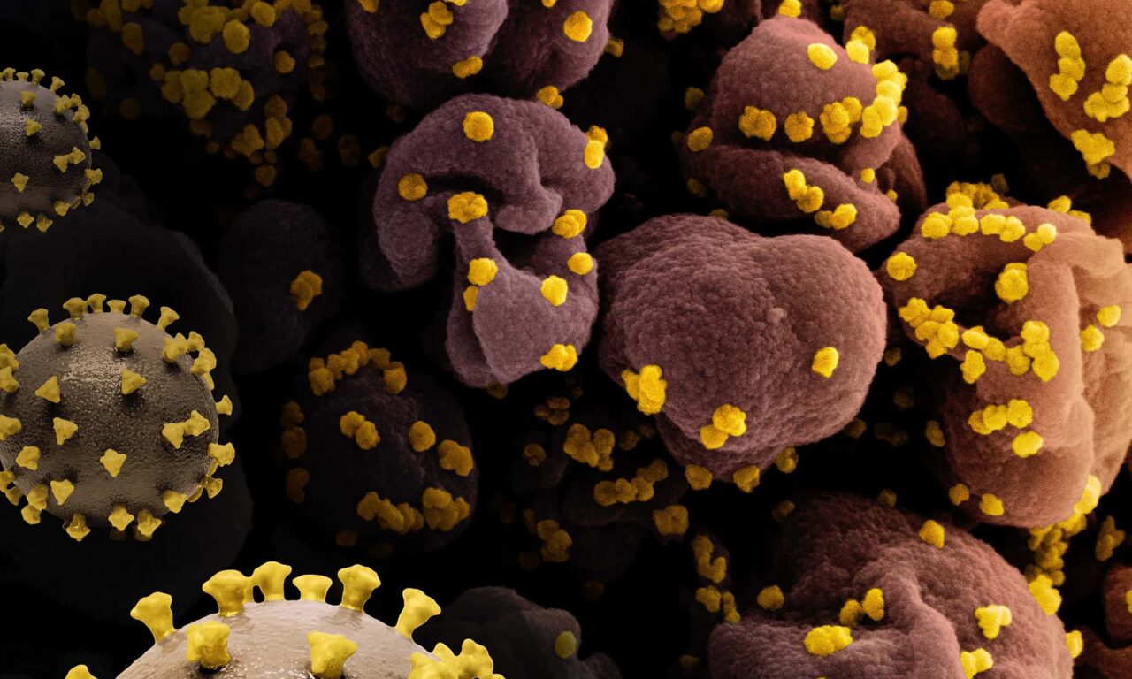Long COVID Increases Children’s Kidney, Heart, and Gut Risks