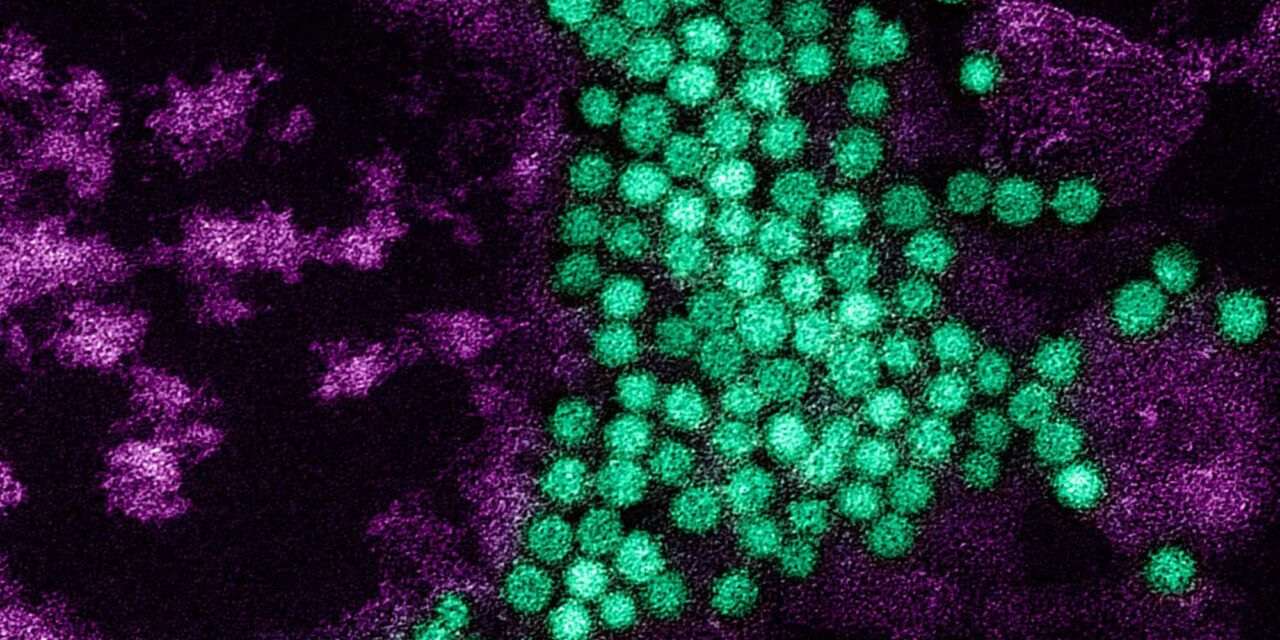 Enterovirus D68 a Threat to Non-Asthmatic Children