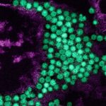 Enterovirus D68 a Threat to Non-Asthmatic Children