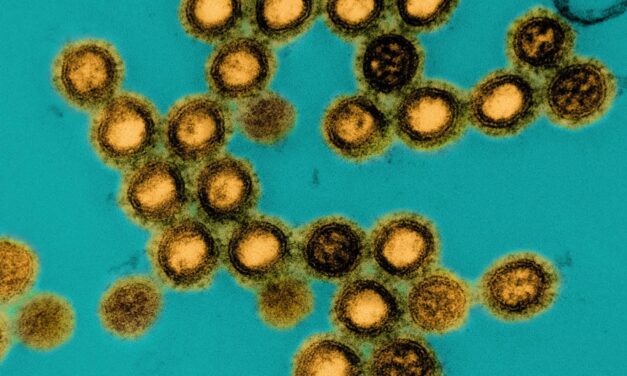 Influenza D Virus Replicates in Human Lung Cells