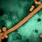 Pediatric Influenza Tied to Neuropsychiatric Events