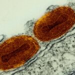 Scientists Find Gaps in Evidence of Human Outcomes and Harms for Engineering Infection Control Interventions
