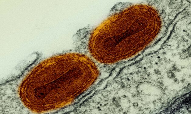 Scientists Find Gaps in Evidence of Human Outcomes and Harms for Engineering Infection Control Interventions
