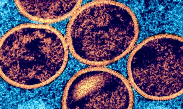 58% of Patients Affected by 2022 Mpox Outbreak Report Lasting Physical Symptoms