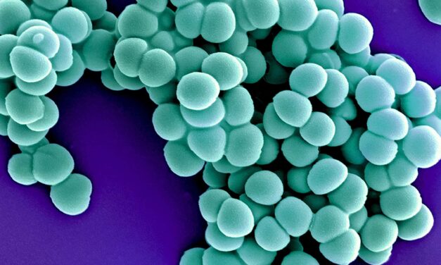 Certain Nasal Bacteria May Boost COVID-19 Risk
