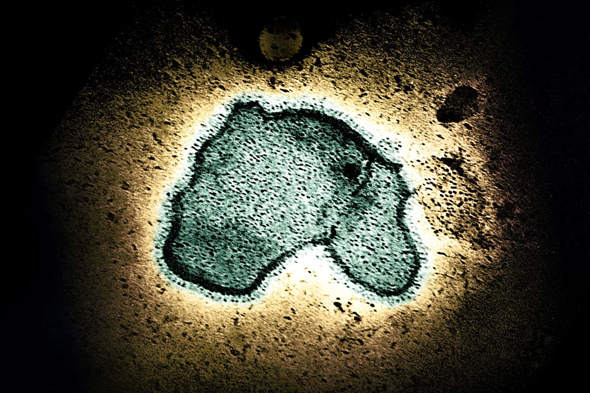 Infant Immune Response May Explain RSV Severity Compared to SARS-CoV-2