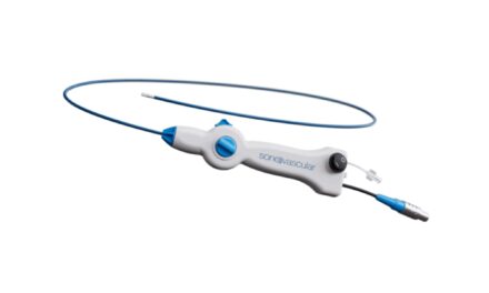 SonoThrombectomy Ultrasound System Shows Promise as Embolism Therapy