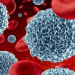 Sleep, Exercise Reduce CV Risk From Mutated White Blood Cells