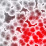 Sleep, Exercise Mitigate Cardiovascular Risk From Blood Mutations