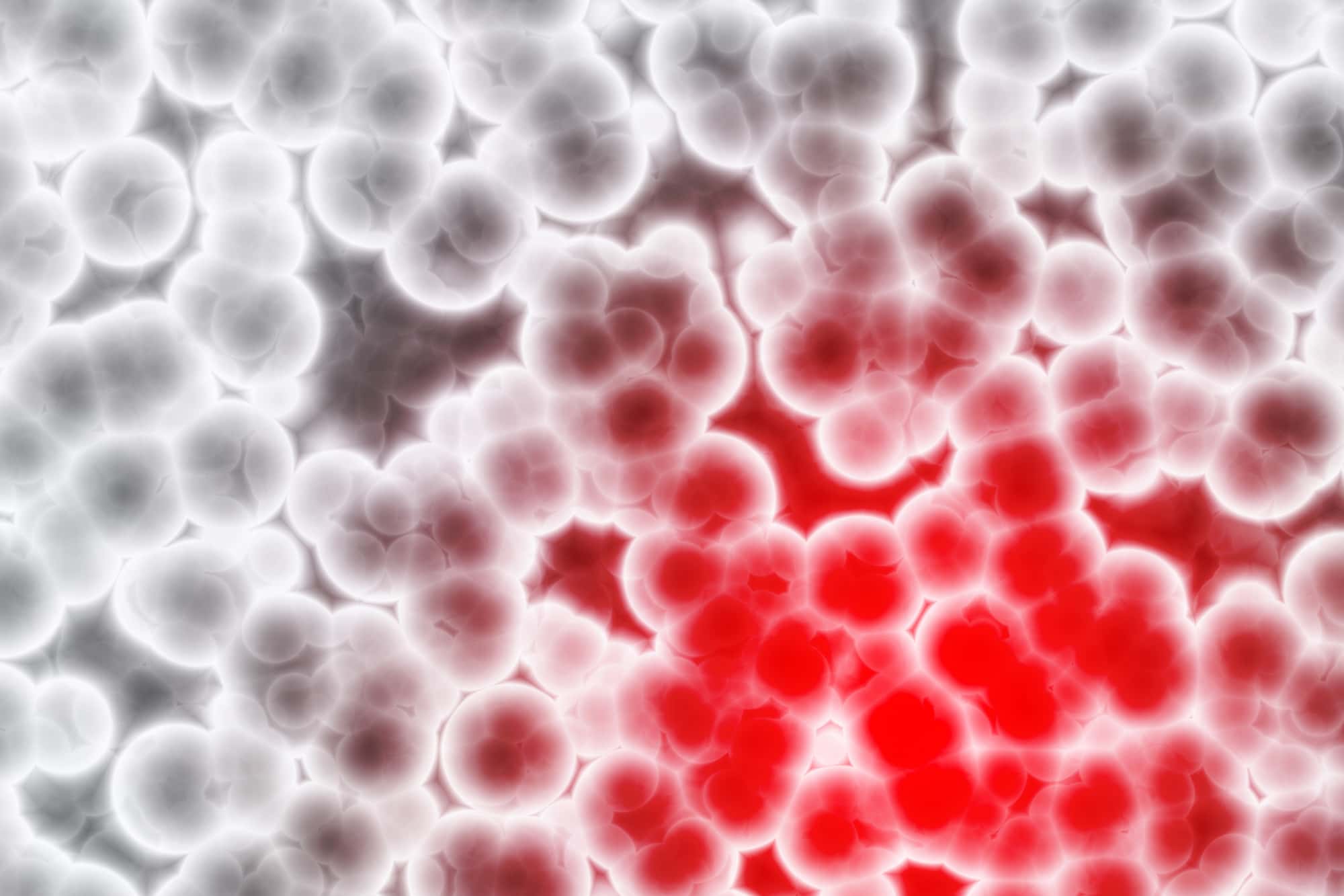 High RSV Hospitalization for Immunocompromised Adults