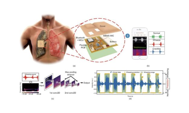 Wearable Stethoscope Accurately Monitors Lung Sounds