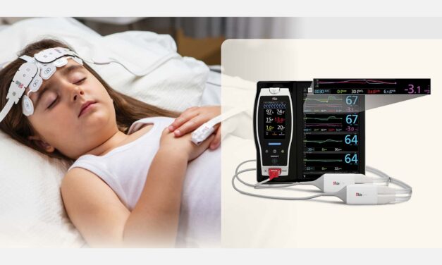 Masimo O3 Regional Oximetry