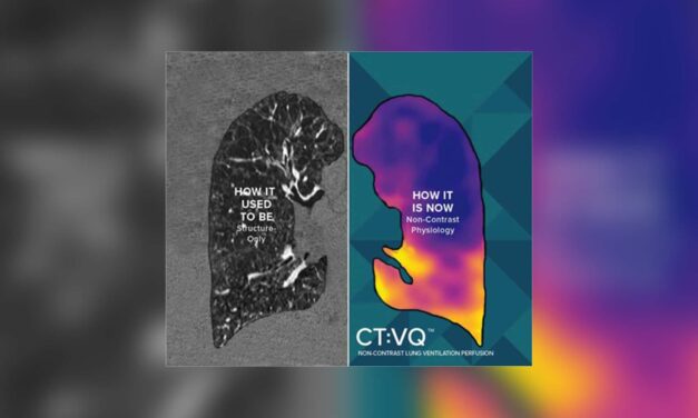 4DMedical to Expand Software-Based Lung Imaging in US