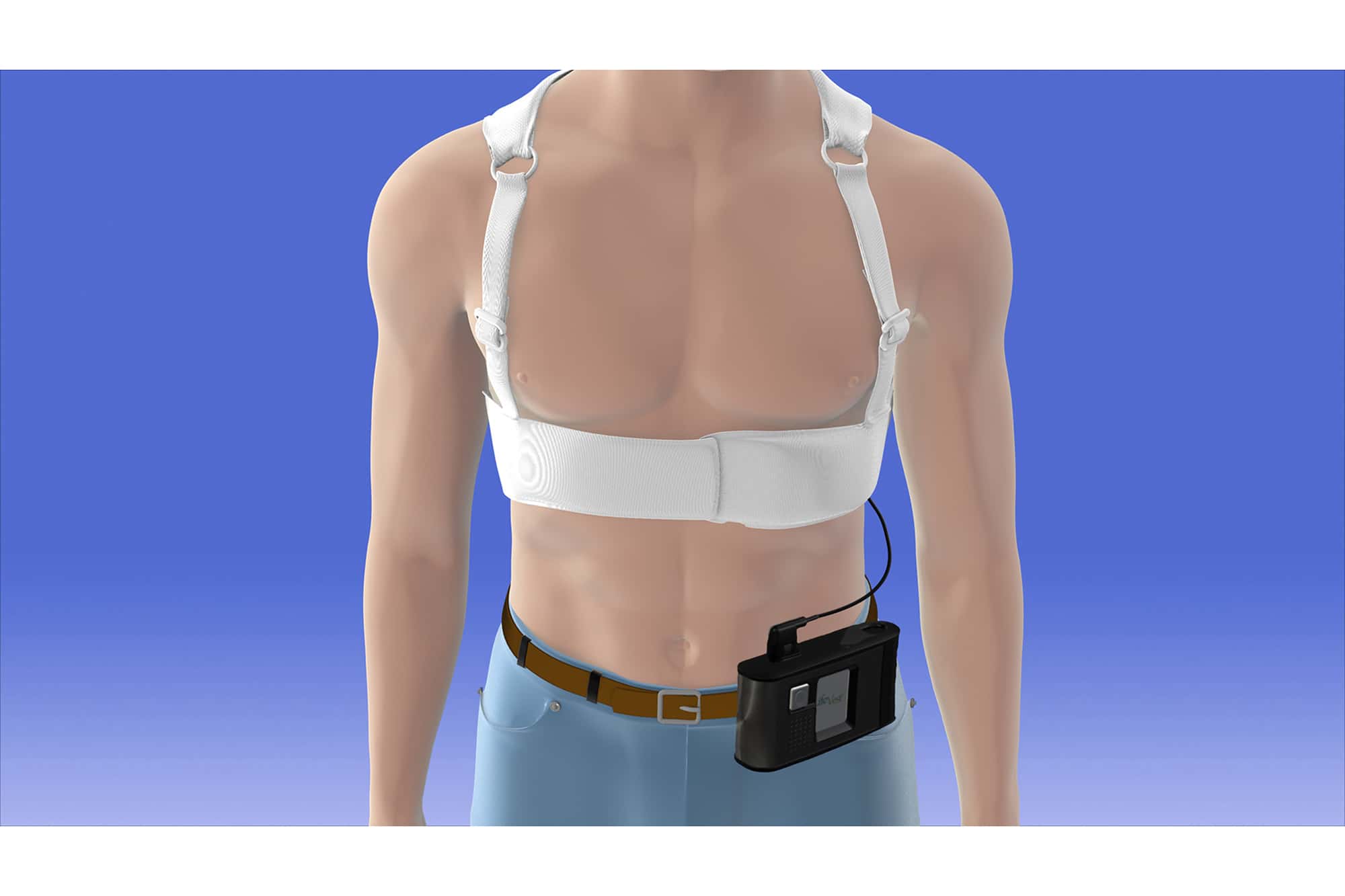 Zoll LifeVest wearable cardioverter defibrillator via https://www.prnewswire.com/news-releases/lifevest-wearable-defibrillator-reduces-total-mortality-by-36-percent-at-90-days-300611957.html