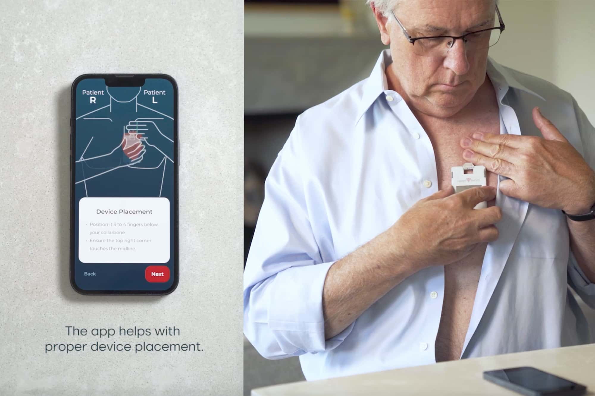 HeartBeam’s 12-lead ECG synthesis software