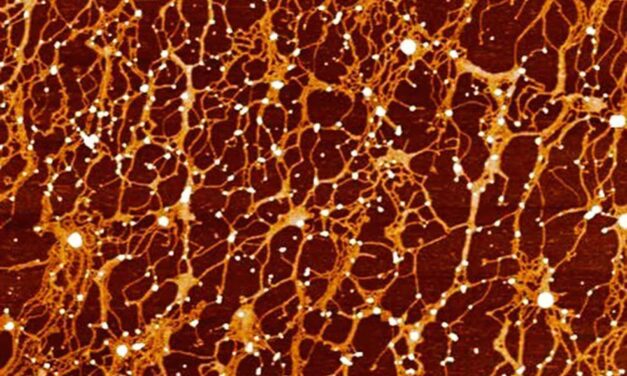 Quantitative Mucin Index: a New Metric to Monitor Lung Health