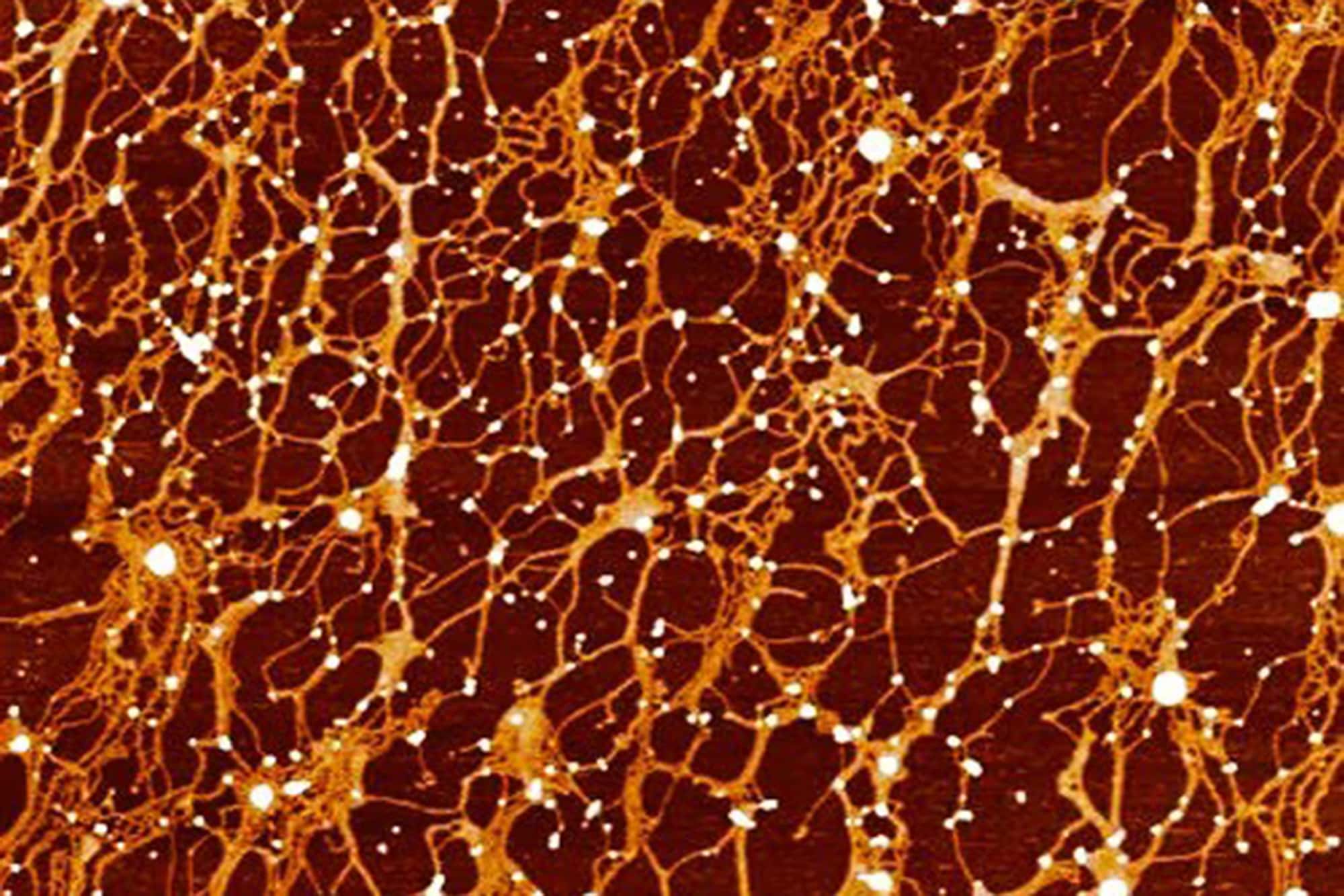 Quantitative Mucin Index: a New Metric to Monitor Lung Health