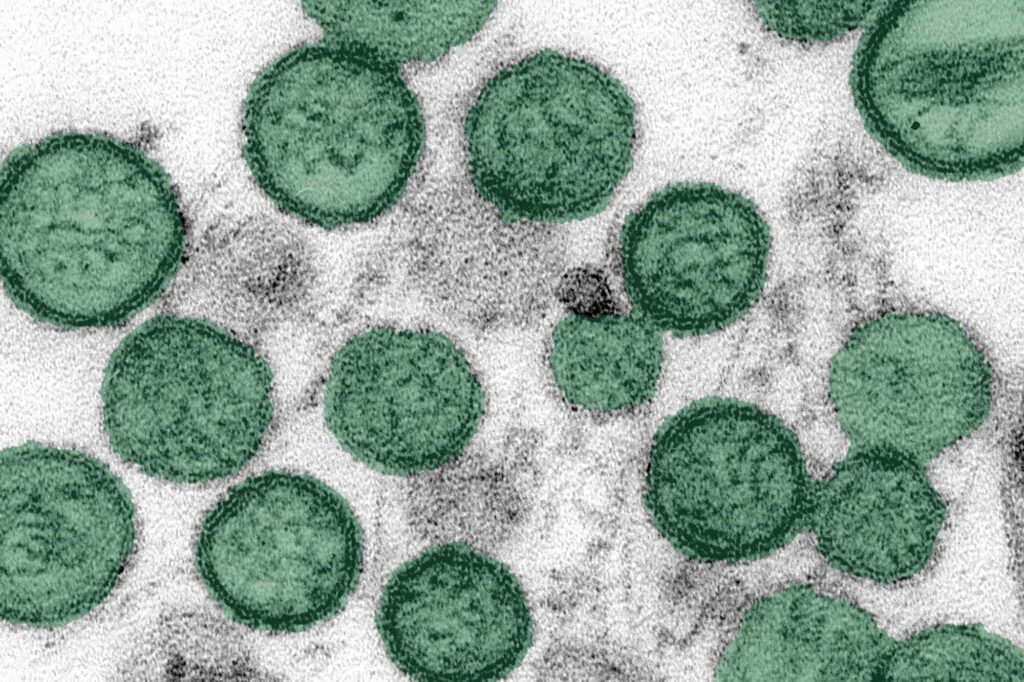 hantavirus cdc