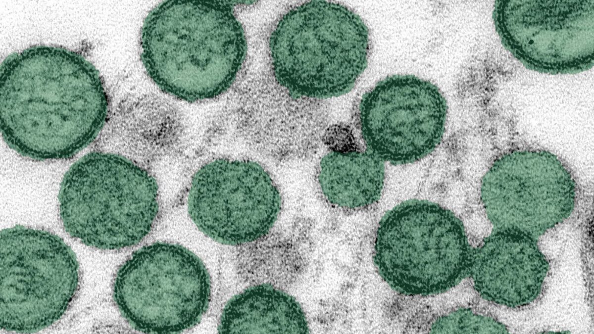 Hantavirus Outbreak on Cruise Ship Leads to Three Deaths | Respiratory Therapy