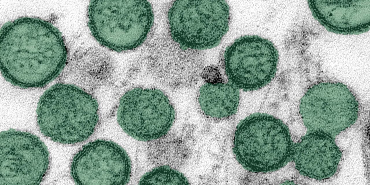 Hantavirus Outbreak Highlights Person-to-Person Transmission Risks