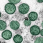 HHS Suspends Hantavirus Monitoring