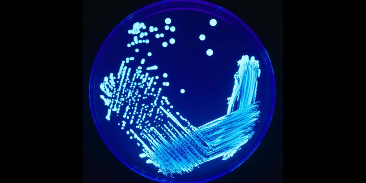 Legionnaires’ Cluster Kills Five in New York City