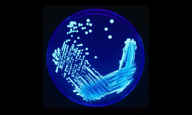 Legionnaires’ Cluster Kills Five in New York City