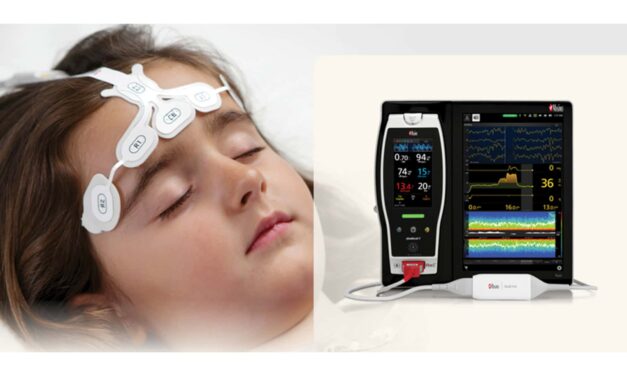 FDA Clears Masimo Pediatric Sedation Monitoring Tool