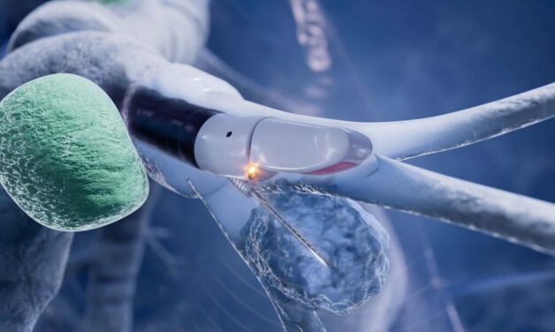 Olympus Launches Slim EBUS Bronchoscope