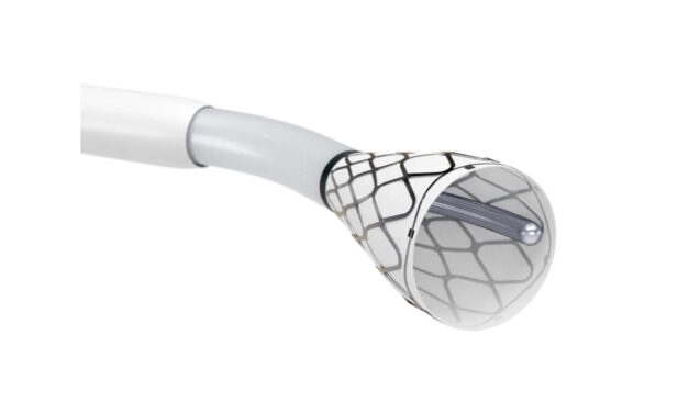 FDA Clears New Blood Clot Removal System for PE