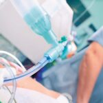 Ai Detected Hidden Complications Before Extubation