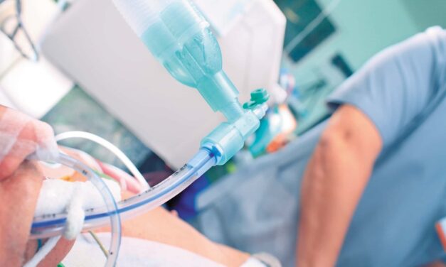 Ai Detected Hidden Complications Before Extubation