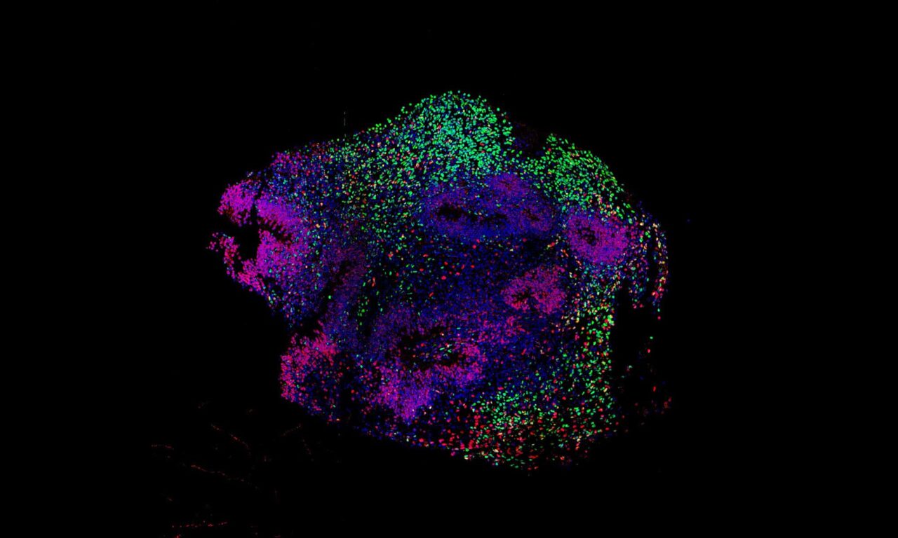How Anesthesia Affects Neural Activity