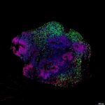 How Anesthesia Affects Neural Activity