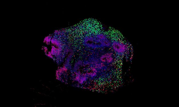 How Anesthesia Affects Neural Activity